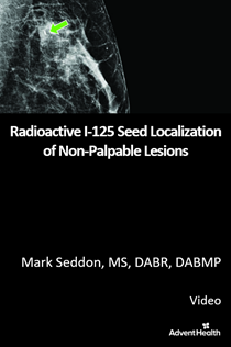 2025 Radioactive I-125 Seed Localization of Non-Palpable Lesions (IEM) Banner